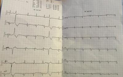 Elektrokardiyografi (EKG) Hizmeti